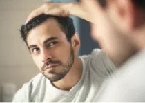 SOS Cheveux Homme : nos solutions anti-chutes